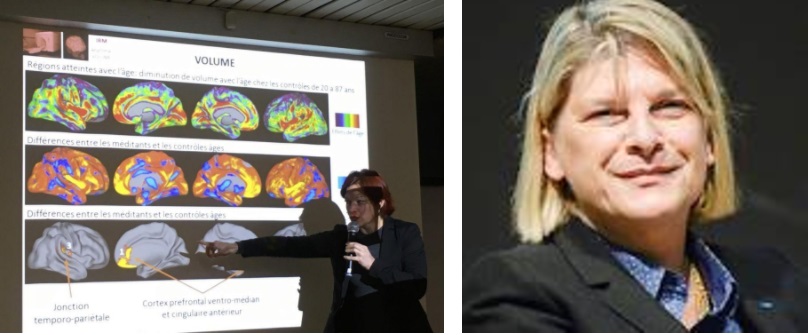Phép thiền định có thể ngăn ngừa bệnh kém trí nhớ Alzheimer