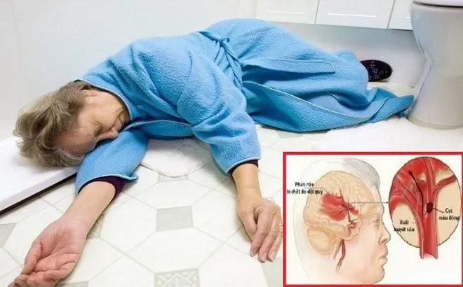 Mẹo hay giúp cứu người bị đột quỵ và tai biến image-1731946451713